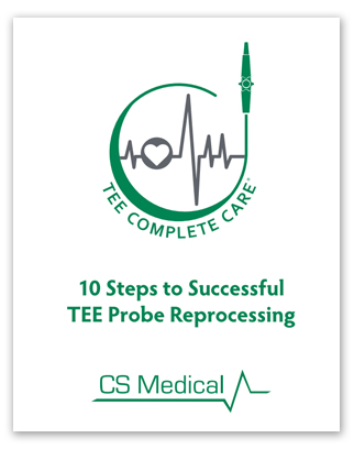 10 Steps to Successful TEE Probe Reprocessing